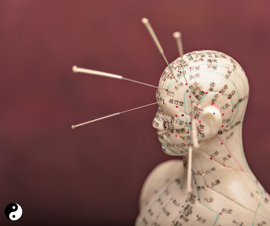 Acupuncture